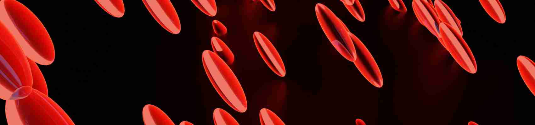 leg blood clot symptoms, prevent deep vein thrombosis