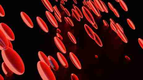 leg blood clot symptoms, prevent deep vein thrombosis