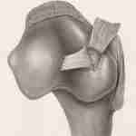 hip pain relief, hip mobility exercises