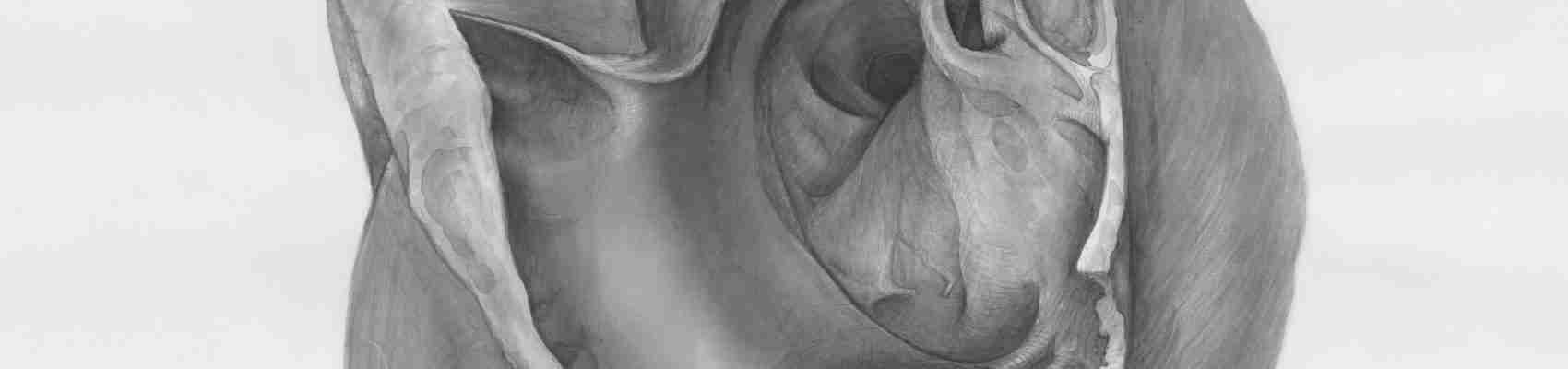 leaky heart valve, valve regurgitation