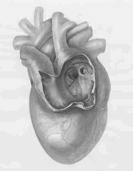 leaky heart valve, valve regurgitation