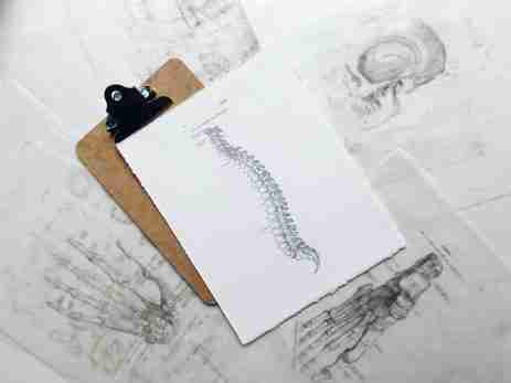 spine surgery, spine surgeon