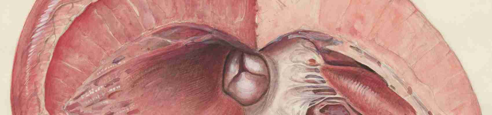 liver cirrhosis, early symptoms