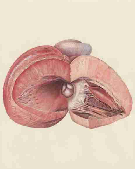 liver cirrhosis, early symptoms